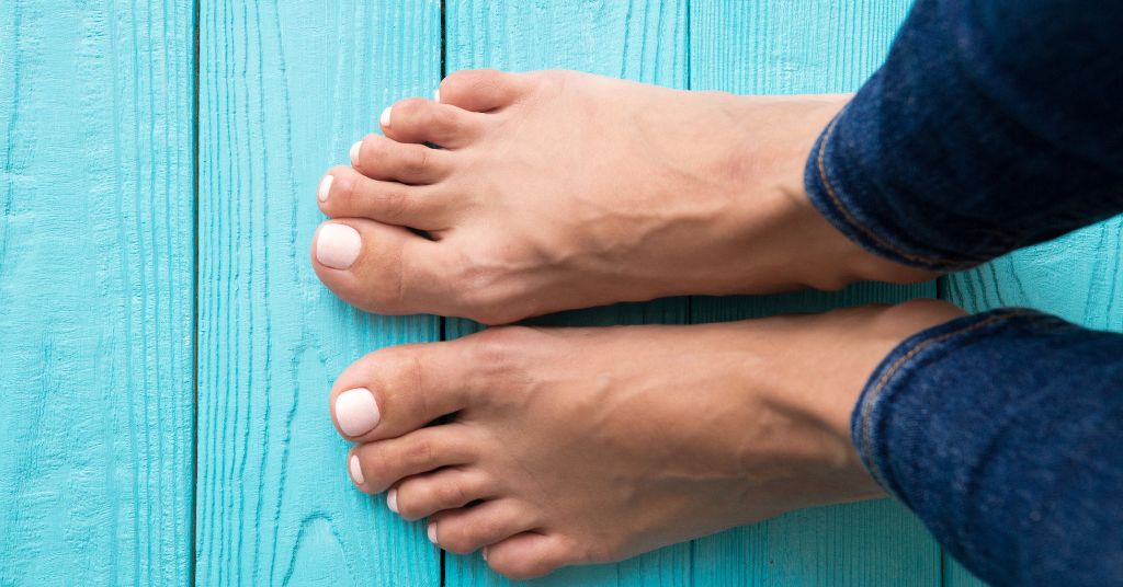 Diabetes and Leg & Foot Problems: Causes, Prevention, and Natural Support